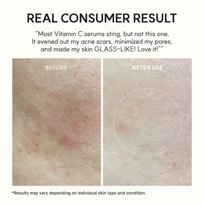 Arencia Vitamin C Booster Shot — Face & Eye Cream Moisturizer