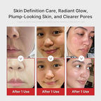 Medicube Age-R Booster Pro Pink skincare device – photo 4