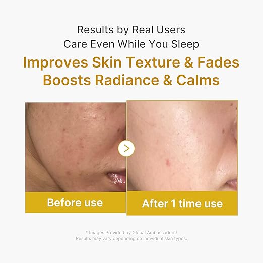 Medicube Turmeric Overnight Wrapping Peel Off Mask