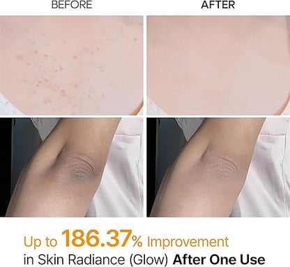 Dr.Melaxin Kojic Acid Exfoliating Spray 200ml