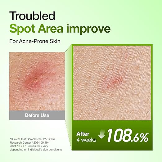 ANUA Azelaic Acid 10% Soothing Serum 30ml