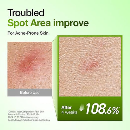ANUA Azelaic Acid 10% Soothing Serum 30ml